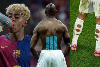 Il Barcellona e le bende ai polsi: gli altri strumenti medici diventati moda