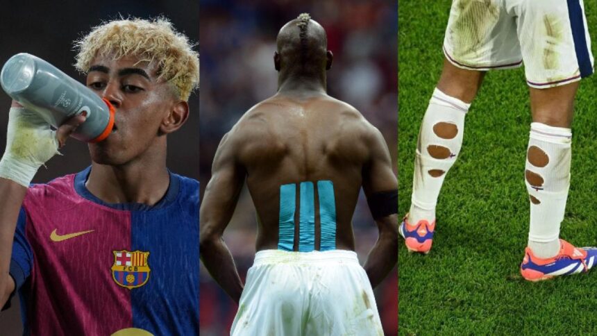 Il Barcellona e le bende ai polsi: gli altri strumenti medici diventati moda