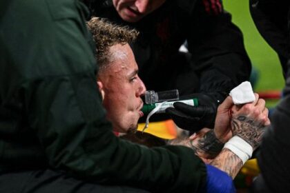 Infortunio sconvolgente al dito per Noa Lang, si schianta contro un cartellone e si apre il pollice: rischio operazione